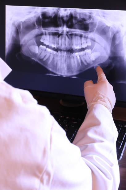 Best Emergency Root Canal Treatment in Prosser, WA